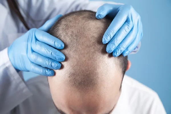 Hair Treatment Services